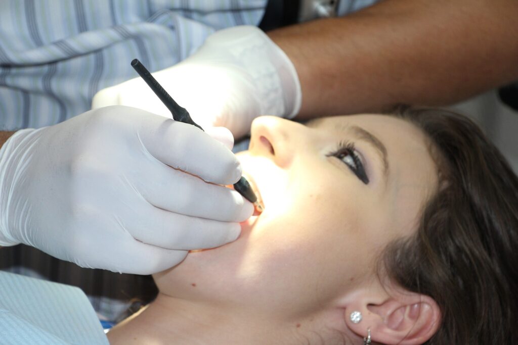 Teeth Polishing and Scaling